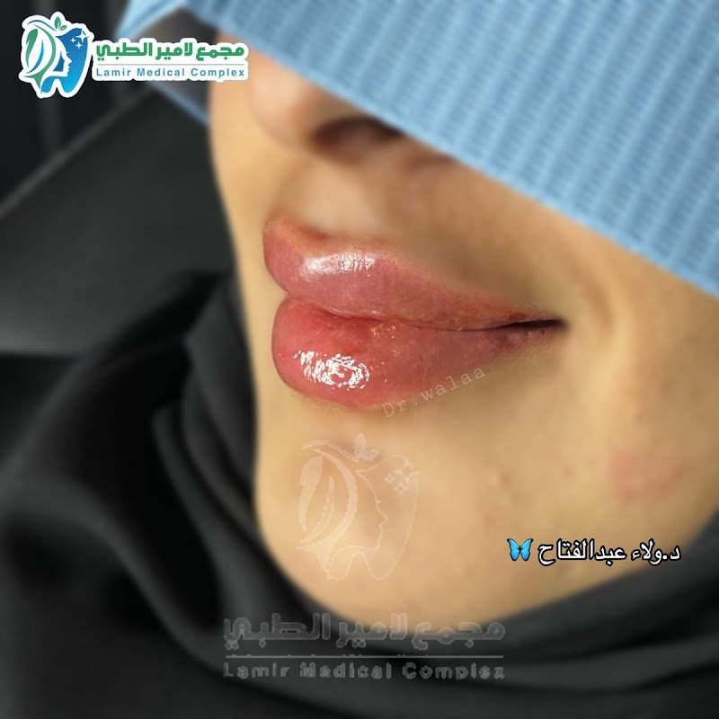 مجمع لامير الطبي